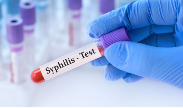 Syphilis Test