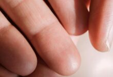 contact number analysis overview